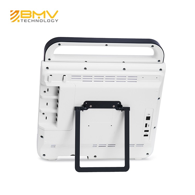 15″ Touchscreen Pad B/W Compact Portable Veterinary Ultrasound Surgical, Lab & Therapy 15" Touchscreen Pad B/W Compact Portable Veterinary Ultrasound - Image 3